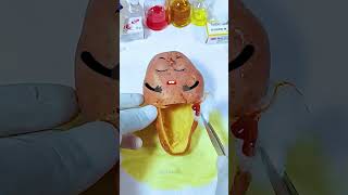 Potato has a baby Need Emergency Surgery jidoodle fruitsurgery foodsurgery [upl. by Ressan401]