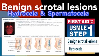 Benign scrotal lesions Hydrocele amp Spermatocele in HindiUrdu by first aid for USMLE step 1 [upl. by Aylsworth404]