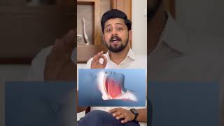 കൂർക്കംവലി‼️അപകടകാരി🚨 അറിയൂyoutubeshorts shorts short [upl. by Itnuahsa]