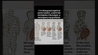 Can u pop Abortion pills from the medical shop abortion fertility pregnancy miscarriages pills [upl. by Willem809]