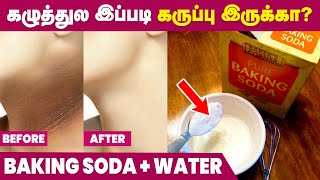 Neck Darkness Removal Home Remedy in Tamil  Dark Neck Tips [upl. by Pierce]