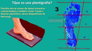 ¿Que indica tu huella plantar l Podologia [upl. by Runkel860]