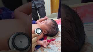 hydrocephalus newborn hydrocephalusbaby congenitalanomaly [upl. by Hubing]