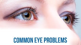 Common Eye Problems hindi [upl. by Gies]