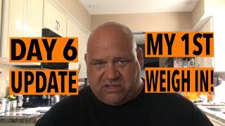 1st Weigh In Day 6 Post Op Update After Gastric Sleeve Surgery in Mexico [upl. by Erme45]