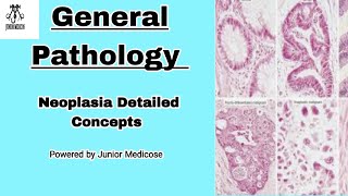 General Pathology MCQ  Neoplasia detailed Discussion  Robbins [upl. by Nicole]