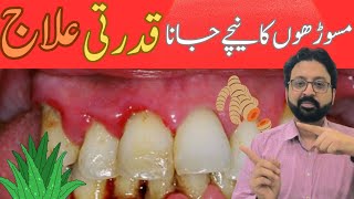 Top 2 Remedies to Cure Gum Recession at Home [upl. by Reginnej710]