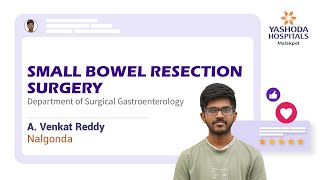 Small Bowel Resection Surgery  Ileo Ileal Anastomosis  Yashoda Hospitals Hyderabad [upl. by Norahc]