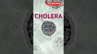 CHOLERA  cholera ricewaterstool choleratreatment signampsymptomsofcholera shortsvideo shorts [upl. by Anomis]