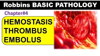 Chp4 Part2 Robbins Basic Patho  Hemostasis  Thrombus  Embolism  General Pathology [upl. by Surat347]