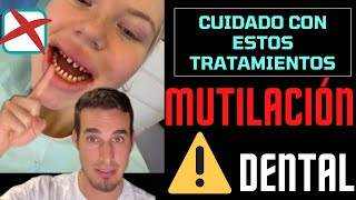 MUTILACIÓN DENTAL  Le liman todos los dientes para quotmejorar su sonrisaquot [upl. by Norre683]