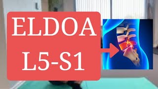 ELDOA L5S1 How To [upl. by Gothurd]