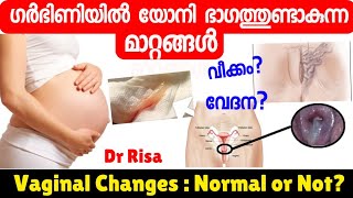 Vaginal Pain amp Swelling in pregnancyVaginal Changes During Pregnancy Malayalam [upl. by Adnerak]