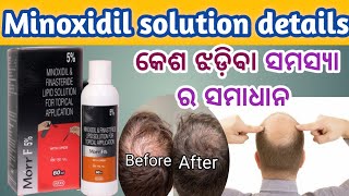 I Tried Morr F 5 Minoxidil  କେଶ ଝଡ଼ିବା ବନ୍ଦ କରିଥାଏ  The Best Hair Loss Treatment [upl. by Ran]