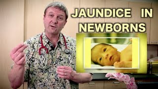 Jaundice in Newborns Pediatric Advice [upl. by Nerok905]