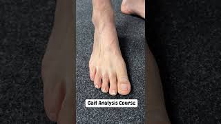 FAST TRACK Your Running Career with Our Gait Analysis Course [upl. by Naryt]