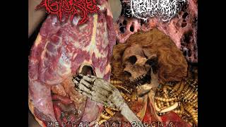 Gore x Hipermenorrea  Medical amp Pathological Splatter Lacerations Split EP [upl. by Madalyn733]