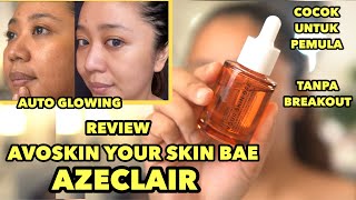 REVIEW AVOSKIN YOUR SKIN BAE AZECLAIR  SERUM UNTUK BEKAS JERAWAT  MENCERAHKAN KULIT [upl. by Jennine]