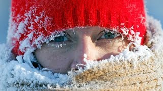 Why frostbite happens how to protect yourself [upl. by Ajup899]