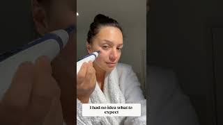 Easy to use Microneedling advice [upl. by Janey]