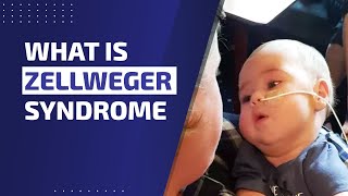 WHAT IS ZELLWEGER SYNDROME [upl. by Suisyola]