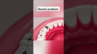 Restoring A Tooth asmr asmrvideo animation dental shorts [upl. by Dream]