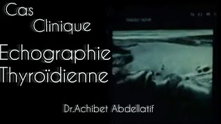 Cas clinique Echographie thyroïdienne  Dr Achibet Abdellatif [upl. by Yerak398]