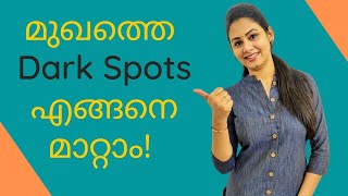 How to Remove Dark Spots  Acne Dark Spots  Malayalam  Keerthis Katalog [upl. by Nylaras]