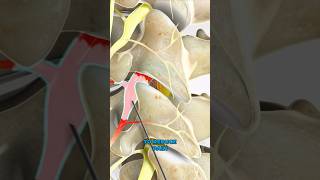 Selective nerve root block 3D Animation [upl. by Felt908]