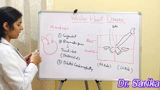 10 VALVULAR HEART DISEASE [upl. by Freeborn]