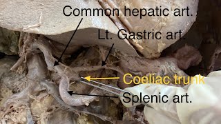 Coeliac trunk and it’s branches  Dr Geetanjali Karle [upl. by Ingmar]