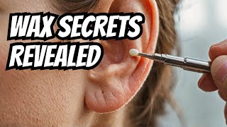 AnikaENT  Ear Wax Removal  The Science Behind Ear Candling Ep85 [upl. by Mitran]