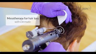 DERMATIC mesotherapy gun for hair loss [upl. by Acinemod]