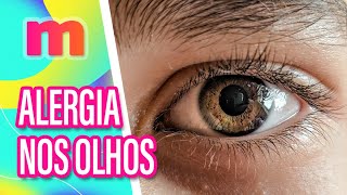 Como tratar CONJUNTIVITE e ALERGIA nos OLHOS  Mulheres 25062024 [upl. by Wesley]