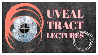 UVEAL TRACT lecture 5 INTERMEDIATE UVEITIS easy explanation [upl. by Rehpetsirhc202]