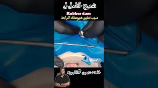 Rubber dam application demo الكربولة endodontics [upl. by Eskil608]