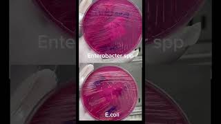 Ecoli và Enterobacter spp khác nhau ra sao Đố bạn trả lời đúng labreport ecoli enterobacter [upl. by Vidal823]