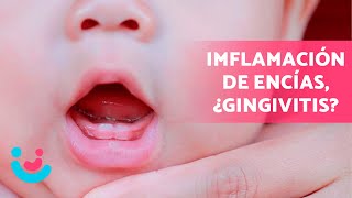 ENCÍAS INFLAMADAS en BEBÉS 😷👶🏻 ¡CUIDADO ¿Cómo Tratar la Gingivitis en Niños [upl. by Amaleta]