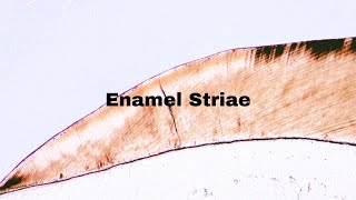 Enamel Striae  Incremental lines of retzius  Dentistry Oral Histology 🔬 [upl. by Nauqet]