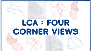 Left Coronary Artery Angiogram The Four Corners Overview [upl. by Gil177]