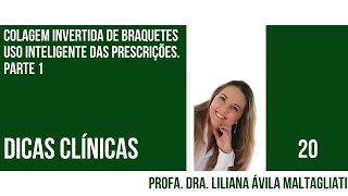 Colagem Invertida de Braquetes  Uso inteligente das prescrições Parte 1 [upl. by Ciardap]