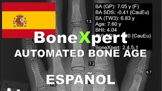 Edad ósea automatizada con BoneXpert  preciso y fácil [upl. by Annayk713]