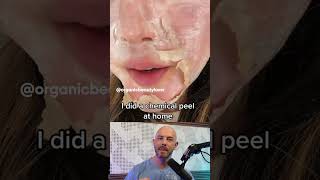 Reacting to this chemical peel thats done at home 🫣 credit organicbeautylover on TT [upl. by Hsekar265]