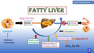 7 Fatty Liver  Lipid Metabolism7  Biochemistry  NJOY Biochemistry [upl. by Rizika]