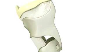 Hyoid Bone Elevation from 3D Swallow [upl. by Wendye331]