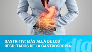 Gastritis más allá de los resultados de la gastroscopia [upl. by Bast]