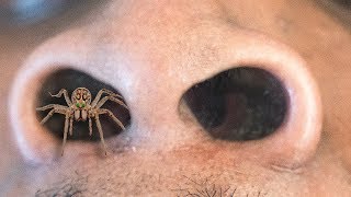 GIANT Spider Gets STUCK in My Friends NOSE [upl. by Adnelg]