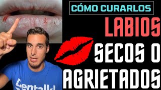 Cómo curar los LABIOS ROTOS SECOS QUEMADOS o AGRIETADOS  Remedios caseros [upl. by Elletsyrk]