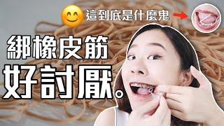 牙齒矯正兩年心得之『我竟然要戴牙套橡皮筋？！😰』會痛嗎？要怎麼吃飯？橡皮筋怎麼戴？｜桑潔牙套日記＃2 [upl. by Nire]