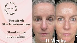 Two Months of Consistent Skincare Results [upl. by Aihsi548]